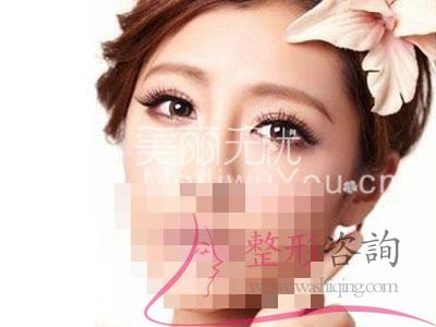 <a href=http://m.f3bb6.cn/listinfo-724-0.html target=_blank class=infotextkey>雙眼皮</a>,<a href=http://m.f3bb6.cn/listinfo-724-0.html target=_blank class=infotextkey>雙眼皮</a>整形手術(shù) <a href=http://m.f3bb6.cn/listinfo-724-0.html target=_blank class=infotextkey>雙眼皮</a>,<a href=http://m.f3bb6.cn/listinfo-724-0.html target=_blank class=infotextkey>雙眼皮</a>整形手術(shù)