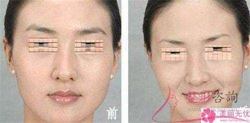 一次皮秒激光<a href=http://m.f3bb6.cn/listinfo-658-0.html target=_blank class=infotextkey>洗眉</a>能夠清潔凈紋眉嗎