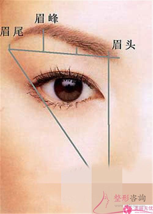 受術者是否能承擔實行種眉毛的價格