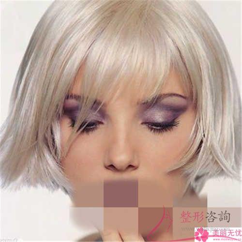 移植額部頭發后作用會持久展現嗎?要怎么樣付費?