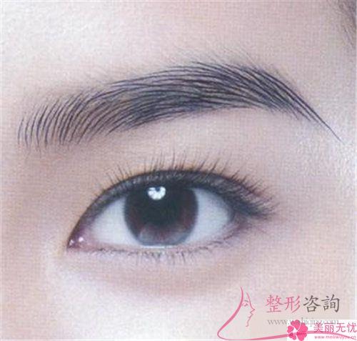 這4類種植眉毛的長處朋友們了解嗎