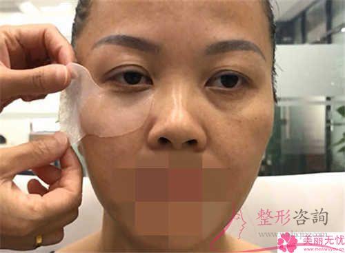 非手術<a href=http://m.f3bb6.cn/listinfo-614-0.html target=_blank class=infotextkey>除皺</a>和手術<a href=http://m.f3bb6.cn/listinfo-614-0.html target=_blank class=infotextkey>除皺</a>有著哪一種效用