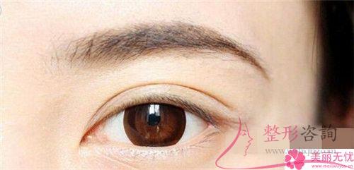 到底怎么樣選取解決掉川字紋的方法，美眉們想問嗎