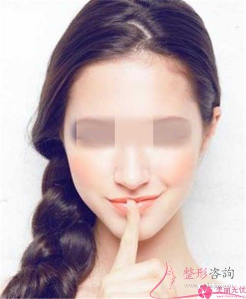 電波拉皮術后就能夠效果展現嗎?面部有些什么轉變呢