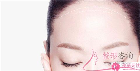 <a href=http://m.f3bb6.cn/listinfo-731-0.html target=_blank class=infotextkey>玻尿酸</a><a href=http://m.f3bb6.cn/listinfo-643-0.html target=_blank class=infotextkey>豐額頭</a>手術(shù)后康復(fù)的時間大概是5-7天嗎