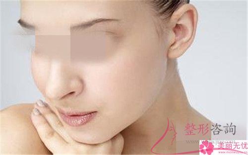 <a href=http://m.f3bb6.cn/listinfo-731-0.html target=_blank class=infotextkey>玻尿酸</a><a href=http://m.f3bb6.cn/listinfo-643-0.html target=_blank class=infotextkey>豐額頭</a>手術(shù)后康復(fù)的時間大概是5-7天嗎