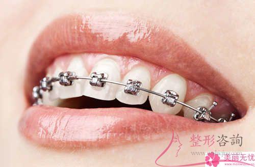 牙齦切除對牙齒有沒有害處