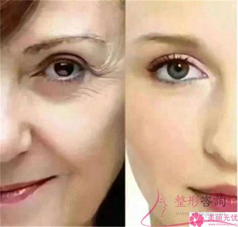 <a href=http://m.f3bb6.cn/listinfo-610-0.html target=_blank class=infotextkey>熱瑪吉</a>有<a href=http://m.f3bb6.cn/listinfo-779-0.html target=_blank class=infotextkey>治療痤瘡</a>和疤痕的效果嗎