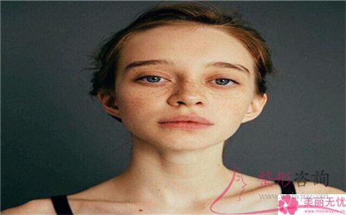 奧美定取出需要注意的四個點(diǎn)有哪些