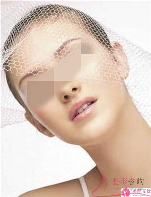 去整形美容機構做激光去痣貴不？多少元錢一顆