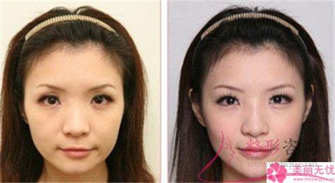 實施復合彩光<a href=http://m.f3bb6.cn/listinfo-770-0.html target=_blank class=infotextkey>嫩膚</a>終止會怎么樣？會復發嗎？