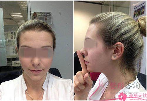 您們真正的明白下<a href=http://m.f3bb6.cn/listinfo-644-0.html target=_blank class=infotextkey>頜骨整形</a>美容嗎