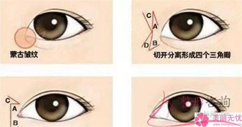 成都實(shí)施無(wú)痕<a href=http://m.f3bb6.cn/listinfo-711-0.html target=_blank class=infotextkey>開眼角</a>術(shù)花多少錢？貴么