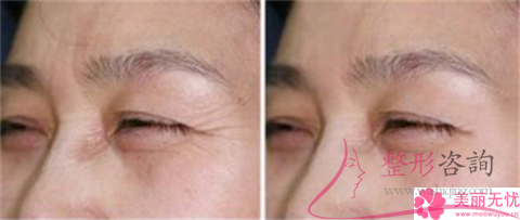 <a href=http://m.f3bb6.cn/listinfo-610-0.html target=_blank class=infotextkey>熱瑪吉</a>第四代和第5代，到底選擇什么效果更佳