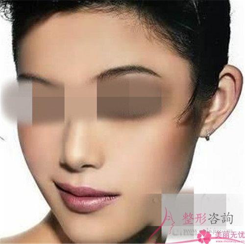 傷口沾水后不利于自體脂肪<a href=http://m.f3bb6.cn/listinfo-694-0.html target=_blank class=infotextkey>豐耳垂</a>后的恢復(fù)嗎