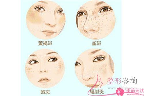 <a href=http://m.f3bb6.cn/listinfo-768-0.html target=_blank class=infotextkey>微針</a>去斑安全性高嗎