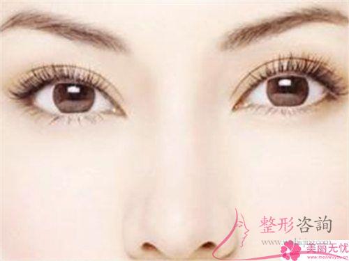 無痕翹睫法<a href=http://m.f3bb6.cn/listinfo-724-0.html target=_blank class=infotextkey>雙眼皮</a>多久能恢復自然