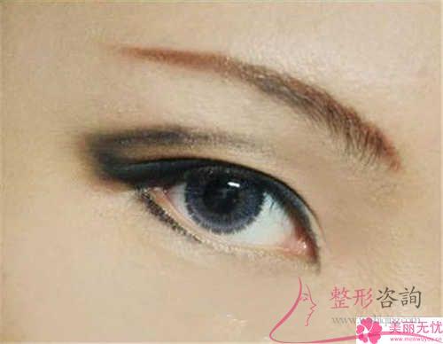 無痕翹睫法<a href=http://m.f3bb6.cn/listinfo-724-0.html target=_blank class=infotextkey>雙眼皮</a>多久能恢復自然