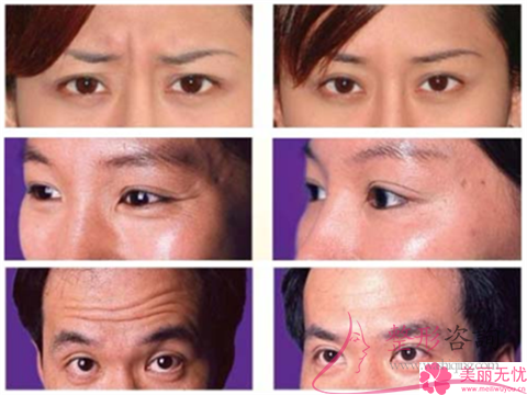 只做一次<a href=http://m.f3bb6.cn/listinfo-610-0.html target=_blank class=infotextkey>熱瑪吉</a>怎么收費？間隙多久二次？