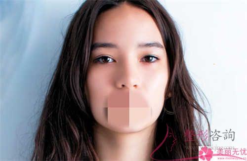 手術<a href=http://m.f3bb6.cn/listinfo-614-0.html target=_blank class=infotextkey>除皺</a>好久可以變得自然