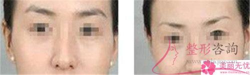 <a href=http://m.f3bb6.cn/listinfo-658-0.html target=_blank class=infotextkey>洗眉</a>毛用激光能清潔凈嗎?費用是呢