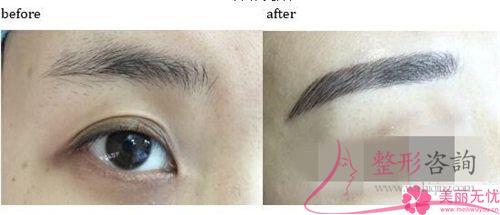 <a href=http://m.f3bb6.cn/listinfo-658-0.html target=_blank class=infotextkey>洗眉</a>毛用激光能清潔凈嗎?費用是呢