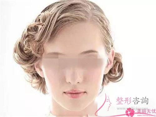 激光<a href=http://m.f3bb6.cn/listinfo-774-0.html target=_blank class=infotextkey>去雀斑</a>樣痣最終價格貴嗎？多少元錢