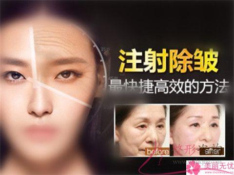 第四代與5代thermage（<a href=http://m.f3bb6.cn/listinfo-610-0.html target=_blank class=infotextkey>熱瑪吉</a>）效應的差別明顯嗎