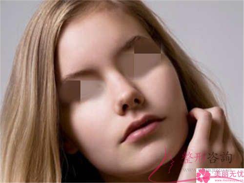 硅膠假體<a href=http://m.f3bb6.cn/listinfo-737-0.html target=_blank class=infotextkey>隆鼻</a>以后應該如何防治病毒感染