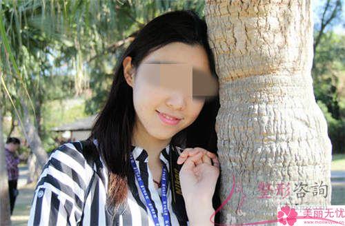 <a href=http://m.f3bb6.cn/listinfo-629-0.html target=_blank class=infotextkey>下頜角</a>整形手術(shù)哪一個(gè)項(xiàng)目美容效果好