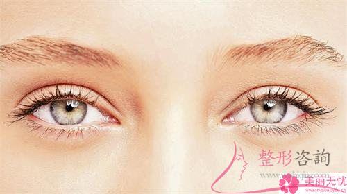 根狀眉與霧狀眉應怎么樣尋到