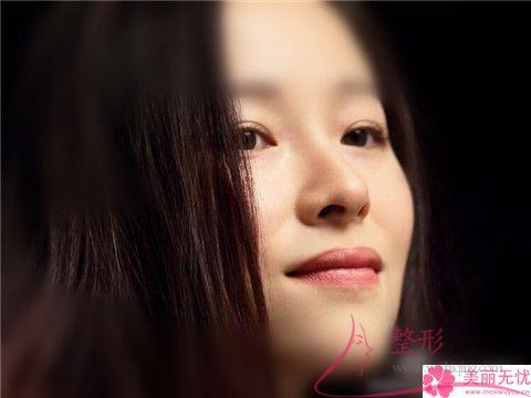 縮小<a href=http://m.f3bb6.cn/listinfo-754-0.html target=_blank class=infotextkey>鼻翼</a>治療一次是要多少？