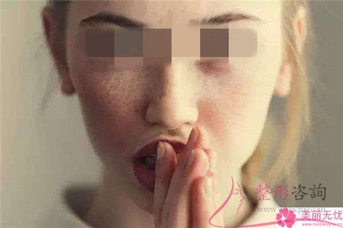 醫美<a href=http://m.f3bb6.cn/listinfo-795-0.html target=_blank class=infotextkey>祛斑</a>期間如果臉上特別紅正常嗎