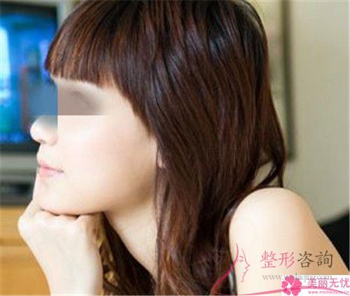 溫州<a href=http://m.f3bb6.cn/listinfo-731-0.html target=_blank class=infotextkey>玻尿酸</a>面部填充<a href=http://m.f3bb6.cn/listinfo-614-0.html target=_blank class=infotextkey>除皺</a>術手術費用貴嗎