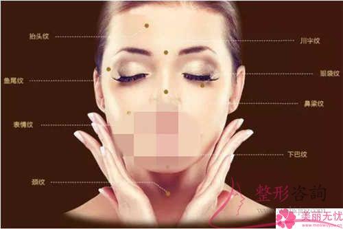 冰電波<a href=http://m.f3bb6.cn/listinfo-614-0.html target=_blank class=infotextkey>除皺</a>整形手術有哪3種特點？治療一次好多元？