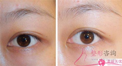 利用干細胞<a href=http://m.f3bb6.cn/listinfo-614-0.html target=_blank class=infotextkey>除皺</a>抗衰能起作用嗎