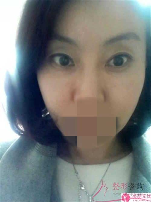 利用干細胞<a href=http://m.f3bb6.cn/listinfo-614-0.html target=_blank class=infotextkey>除皺</a>抗衰能起作用嗎