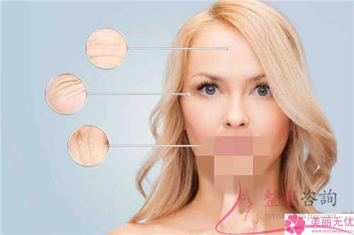 前額的褶皺可不可以應用深層線埋線懸吊緊致去皺方法減少