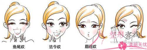 平常的<a href=http://m.f3bb6.cn/listinfo-614-0.html target=_blank class=infotextkey>除皺</a>抗衰成效,鋸齒線懸掛去皺方式能不能達到