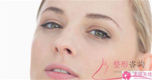 成年女性做自鎖托槽矯正需要多少錢