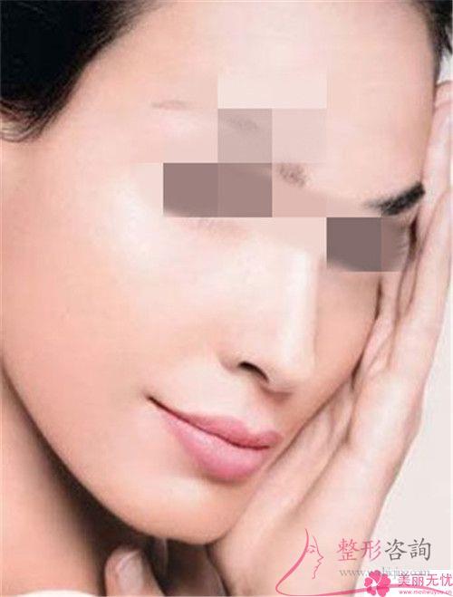 提拉面部哪個(gè)收入階層的美麗女性得以實(shí)行