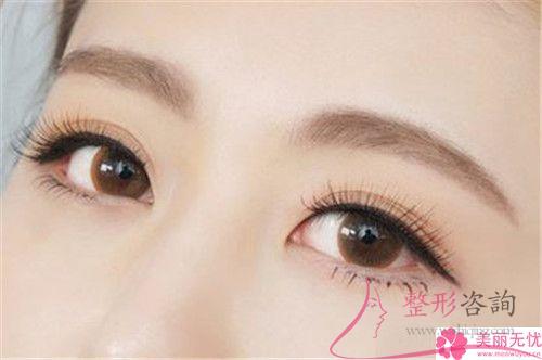 激光祛咖啡斑手術前提因素有哪一些？