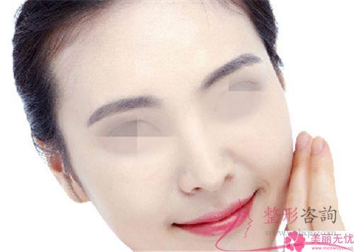 膨體聚四氟乙烯<a href=http://m.f3bb6.cn/listinfo-737-0.html target=_blank class=infotextkey>隆鼻</a>復原時間得要好久?適宜哪些人群?