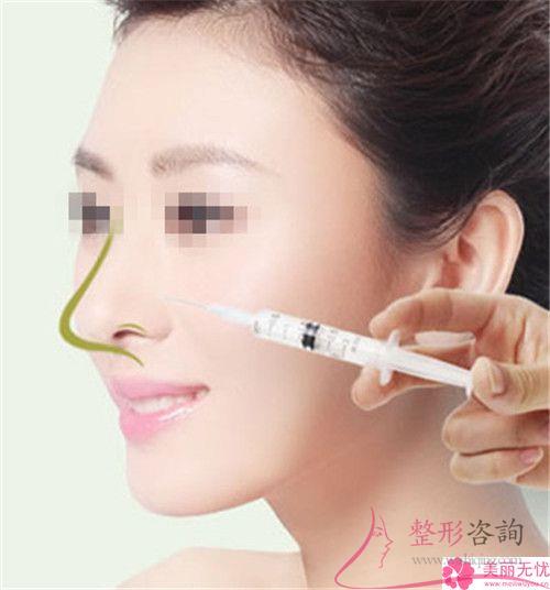 膨體聚四氟乙烯<a href=http://m.f3bb6.cn/listinfo-737-0.html target=_blank class=infotextkey>隆鼻</a>術靠譜嗎？是否有造成感染？