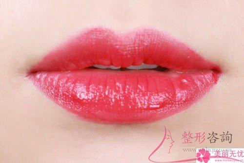 重唇美容術能夠解決哪些現在