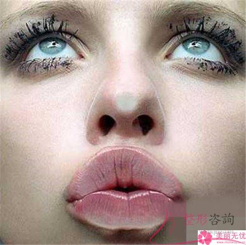 重唇美容術能夠解決哪些現在