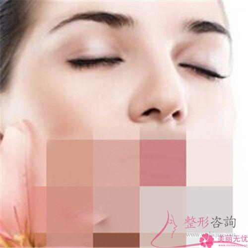 點陣激光祛色斑要經歷多久治療周期