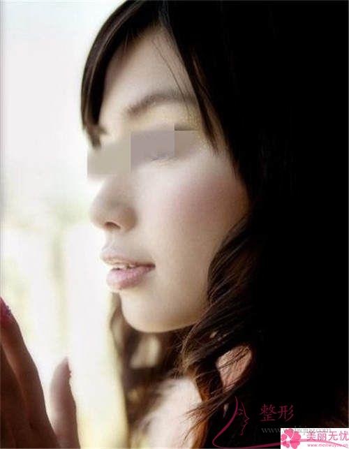 <a href=http://m.f3bb6.cn/listinfo-629-0.html target=_blank class=infotextkey>下頜角</a>截骨手術的費用在12154-21849元之間嗎