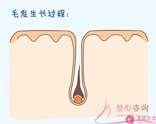 做一次E光永久<a href=http://m.f3bb6.cn/listinfo-670-0.html target=_blank class=infotextkey>脫毛</a>要花多少錢