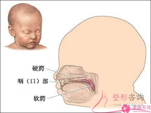 <a href=http://m.f3bb6.cn/listinfo-731-0.html target=_blank class=infotextkey>玻尿酸</a>注射豐嘴唇預測需要多少？